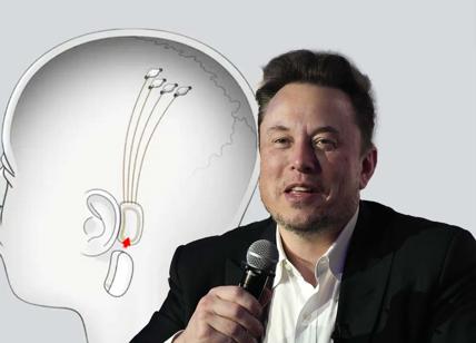 "L'uomo muove il mouse col pensiero", Musk annuncia il successo di Neuralink