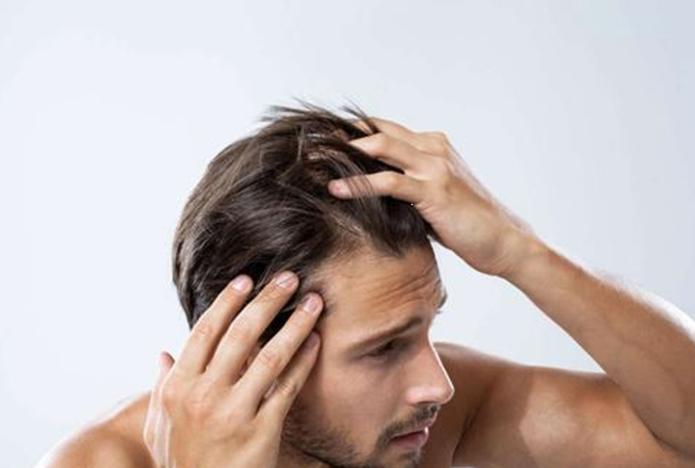 A che età si perdono i capelli? Tutte le statistiche aggiornate