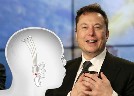 Neuralink, chip nel cervello delle persone: via libera alla start-up di Musk