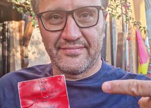 Roma, più facile un fisico che un bagnino. Consigliere comunale si candida