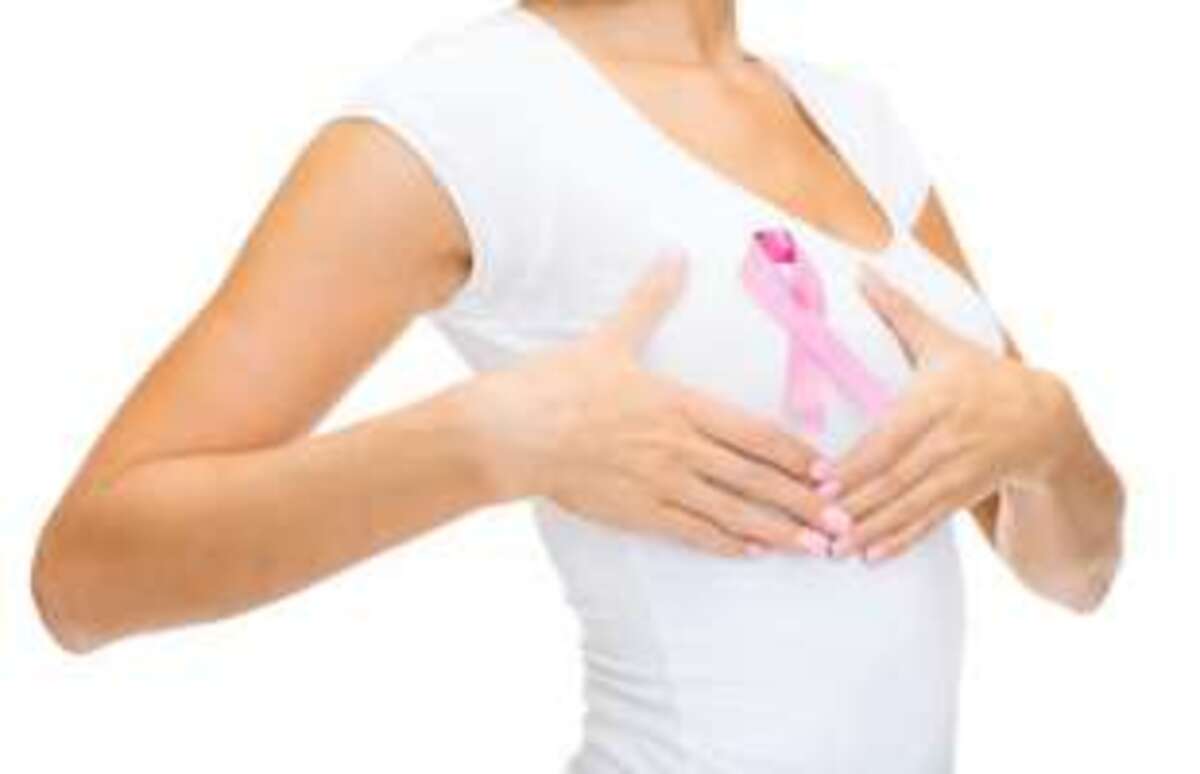Breast most cancers, Siemens Healthineers presents a prevention webinar
