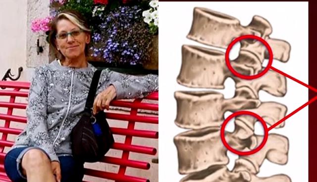 Liliana Resinovich, il giallo della vertebra: per il gip era rotta prima dell’autopsia