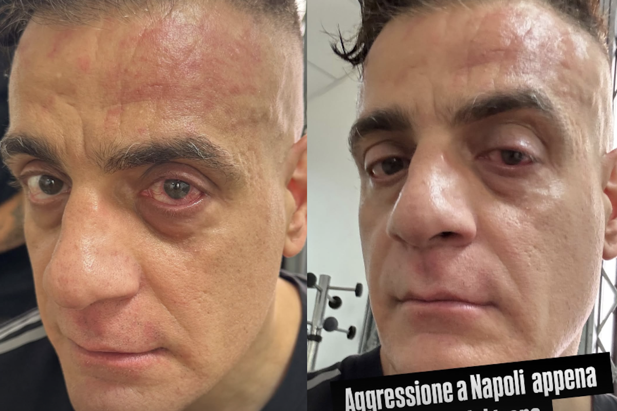 Napoli, aggredito alla stazione lo youtuber romano Cicalone: "Qui non fate video" Napoli, aggredito alla stazione lo youtuber romano Cicalone: "Qui non fate video"