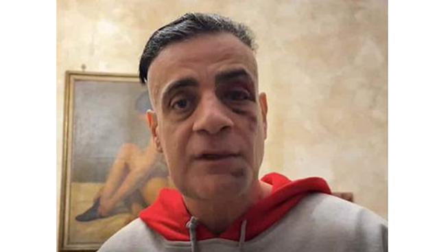 Cicalone aggredito nella stazione metro Ottaviano di Roma: arrestato in Finlandia un uomo, caccia ad altri tre complici