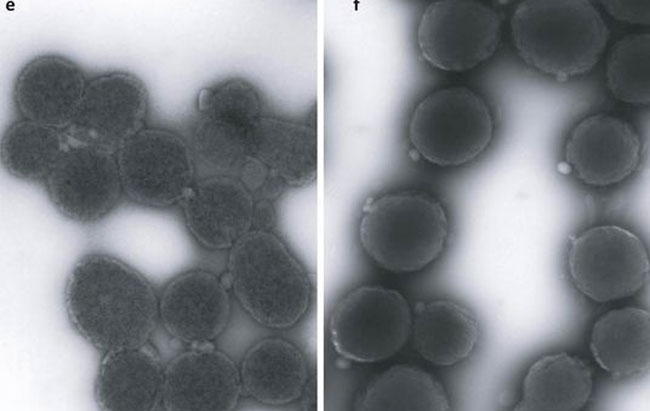 Sistema immunitario: batteri dell'intestino influenzano. Scoperta sul CANCRO