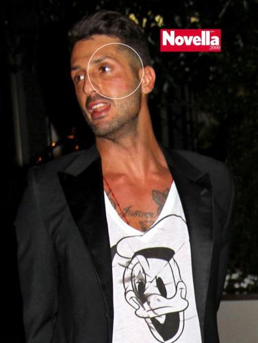 A Zelig Giovanni Vernia imita Fabrizio Corona