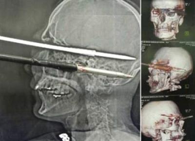 arpione testa 500 arpione testa 500