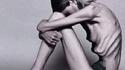“Niente cure, Dio mi curerà”. Muore 19enne anoressica “Niente cure, Dio mi curerà”. Muore 19enne anoressica