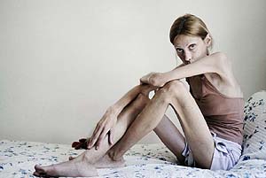 “Niente cure, Dio mi curerà”. Muore 19enne anoressica “Niente cure, Dio mi curerà”. Muore 19enne anoressica