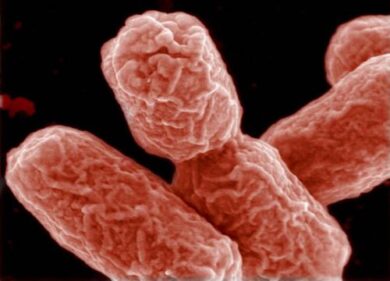Batteri ed escrementi nelle borse. Donne a rischio meningite