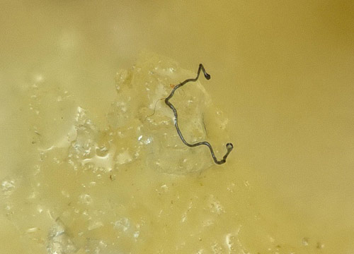 Fibre nella carne di pollo, la denuncia choc