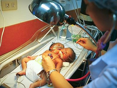Cina: con una lama nel cranio fa la fila in ospedale Cina: con una lama nel cranio fa la fila in ospedale