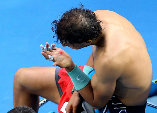 Nadal, terrore per la sua mano. In pericolo l’Australian Open di Rafa Nadal, terrore per la sua mano. In pericolo l’Australian Open di Rafa
