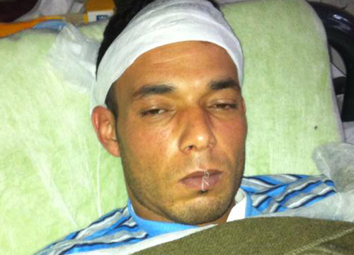 “Bocche cucite” al Cie. Prosegue la protesta “Bocche cucite” al Cie. Prosegue la protesta