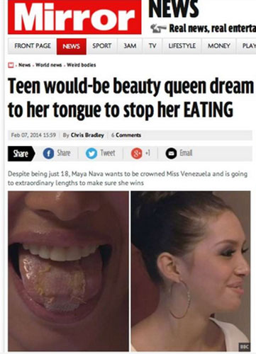 Si cuce la lingua per non mangiare. “Così dimagrisco e divento miss” Si cuce la lingua per non mangiare. “Così dimagrisco e divento miss”