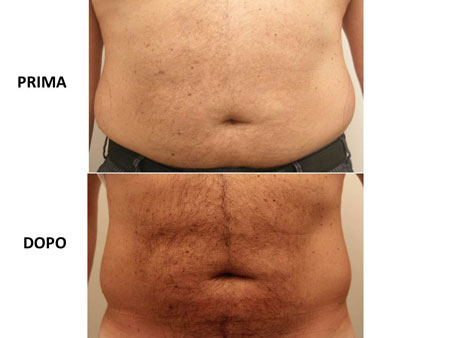 Diapositiva2 Diapositiva2