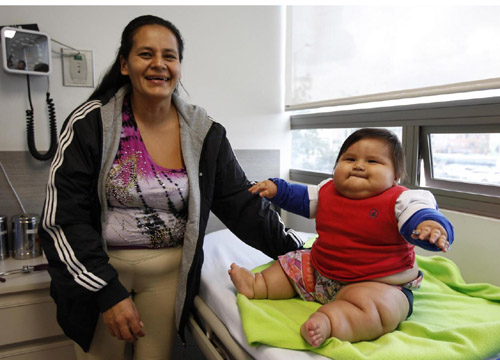 Bimbo obeso: ha 8 mesi e pesa 20 chili. FOTO