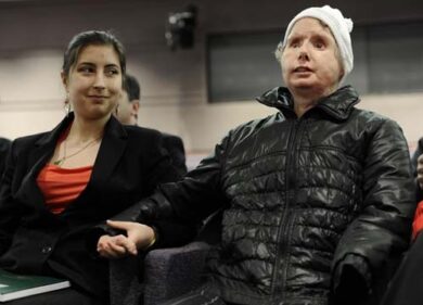 Scimpanzè strappa occhi e mani a una donna. FOTO