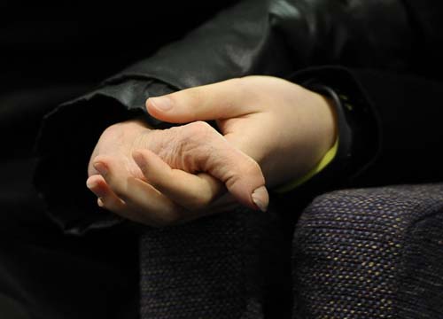 Scimpanzè strappa occhi e mani a una donna. FOTO