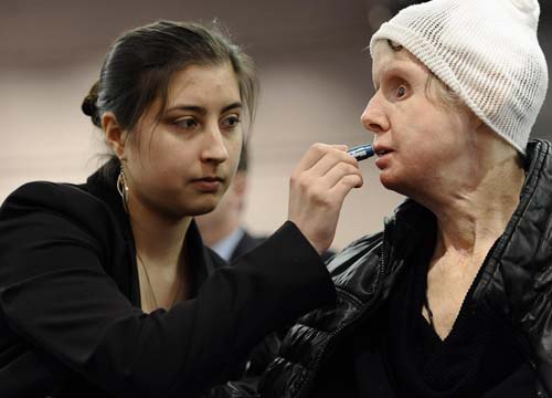 Scimpanzè strappa occhi e mani a una donna. FOTO