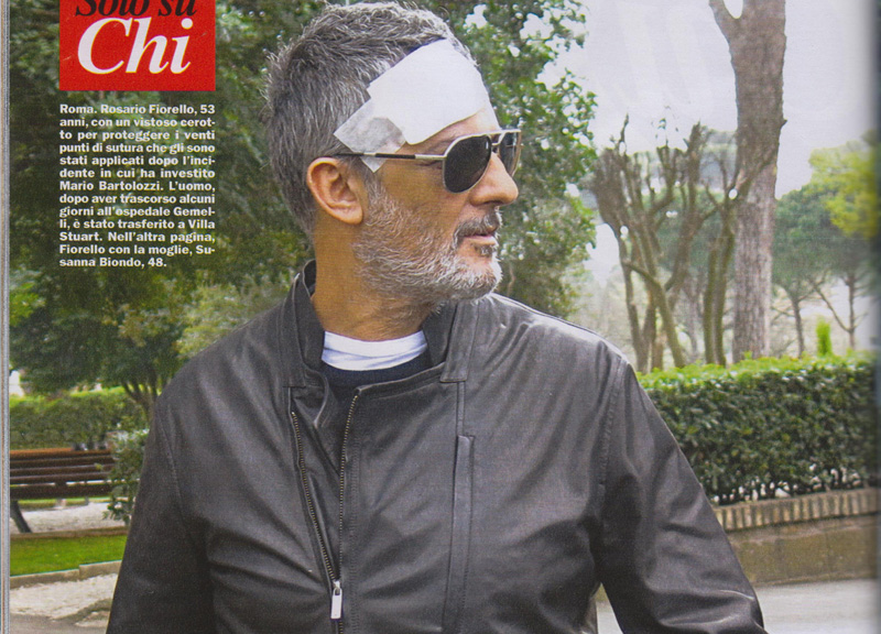 Ecco le foto di Fiorello dopo l’incidente Ecco le foto di Fiorello dopo l’incidente