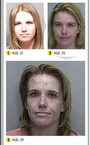 Così la droga stravolge il viso. Campagna choc negli Usa. LE FOTO Così la droga stravolge il viso. Campagna choc negli Usa. LE FOTO