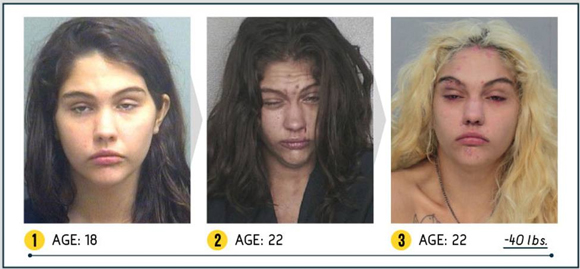 Così la droga stravolge il viso. Campagna choc negli Usa. LE FOTO Così la droga stravolge il viso. Campagna choc negli Usa. LE FOTO