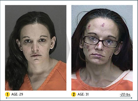 Così la droga stravolge il viso. Campagna choc negli Usa. LE FOTO Così la droga stravolge il viso. Campagna choc negli Usa. LE FOTO