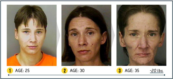 Così la droga stravolge il viso. Campagna choc negli Usa. LE FOTO Così la droga stravolge il viso. Campagna choc negli Usa. LE FOTO