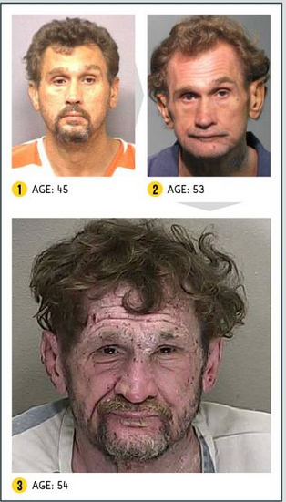 Così la droga stravolge il viso. Campagna choc negli Usa. LE FOTO Così la droga stravolge il viso. Campagna choc negli Usa. LE FOTO