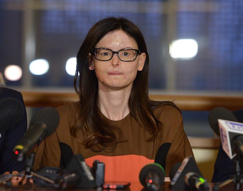 Fece sfigurare l’ex con l’acido. In carcere riceve lettere d’amore