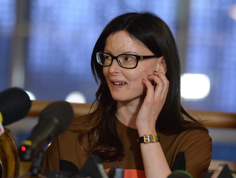 Fece sfigurare l’ex con l’acido. In carcere riceve lettere d’amore