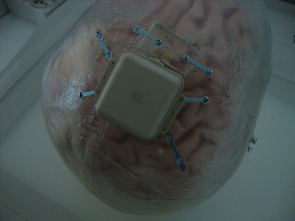 Sos armi elettromagnetiche: qualcuno ci manipola il cervello Sos armi elettromagnetiche: qualcuno ci manipola il cervello