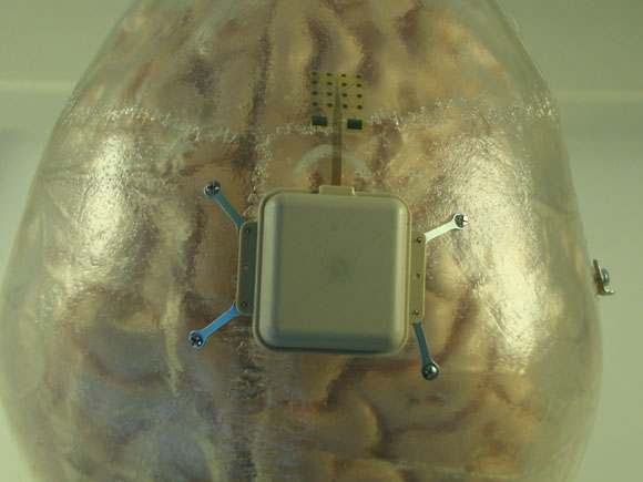 Sos armi elettromagnetiche: qualcuno ci manipola il cervello Sos armi elettromagnetiche: qualcuno ci manipola il cervello