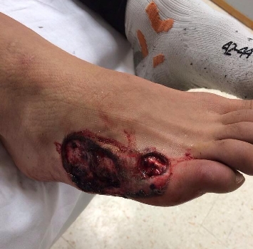 Il fratello di Valentino Rossi salva un pilota ferito Il fratello di Valentino Rossi salva un pilota ferito