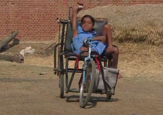 Gemelli siamesi uniti dalle gambe. L’India li considera divinità. FOTO Gemelli siamesi uniti dalle gambe. L’India li considera divinità. FOTO