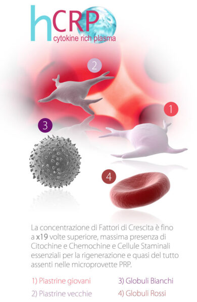 Trapianto capelli, la cura della calvizie va oltre l’autotrapianto