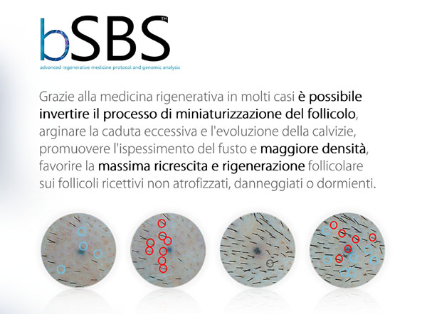 bSBS 3 benefici x2 bSBS 3 benefici x2