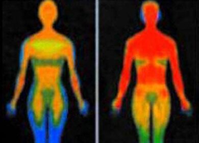 Dichiarata clinicamente morta. Ma torna in vita
