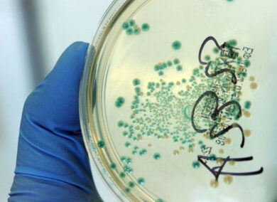 Il batterio che divora la carne dei bagnanti. Scatta il divieto di immersione