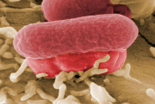 Il batterio che divora la carne dei bagnanti. Scatta il divieto di immersione Il batterio che divora la carne dei bagnanti. Scatta il divieto di immersione