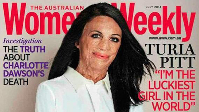 Turia Pitt, sfigurata dalle ustioni. “Ma sono la donna più fortunata” Turia Pitt, sfigurata dalle ustioni. “Ma sono la donna più fortunata”