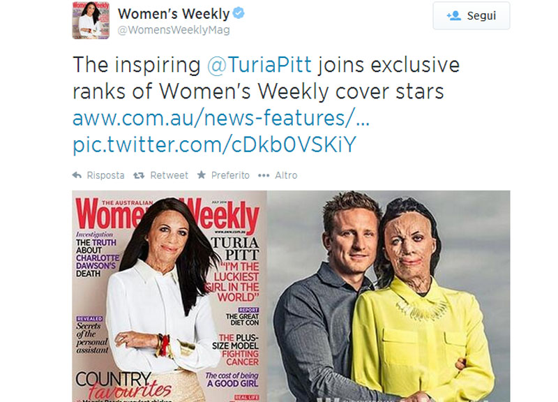Turia Pitt, sfigurata dalle ustioni. “Ma sono la donna più fortunata” Turia Pitt, sfigurata dalle ustioni. “Ma sono la donna più fortunata”