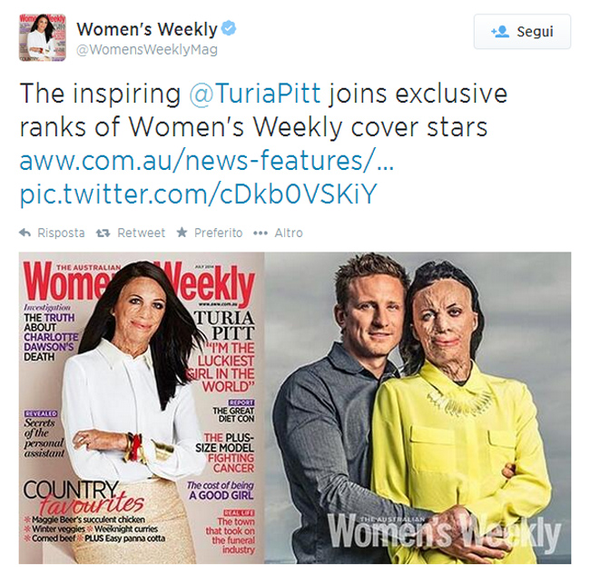 Turia Pitt, sfigurata dalle ustioni. “Ma sono la donna più fortunata” Turia Pitt, sfigurata dalle ustioni. “Ma sono la donna più fortunata”