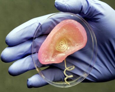 Orecchio bionico e protesi a 30 $: la stampa 3D rivoluziona la medicina