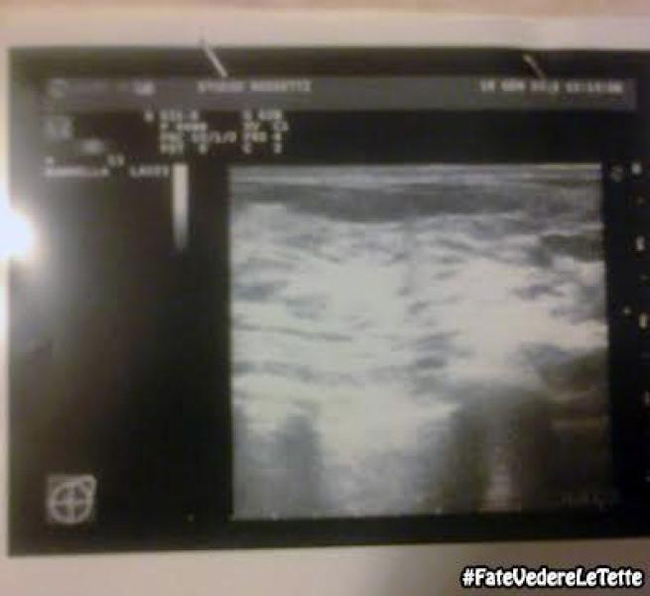#hofattovedereletette, nuovo hashtag. Boom di visite al seno