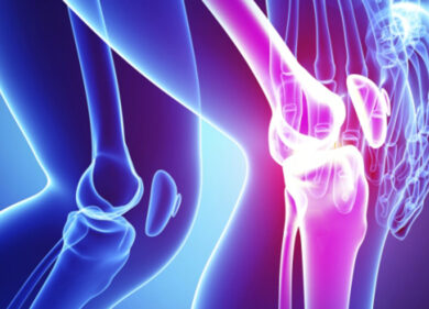 Cellule staminali per curare la cartilagine del ginocchio