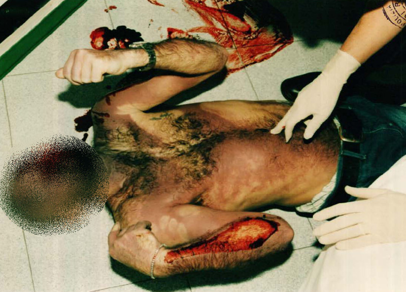 Pantani, parla il perito: “Ecco che cosa non torna nella morte di Marco”. Le foto