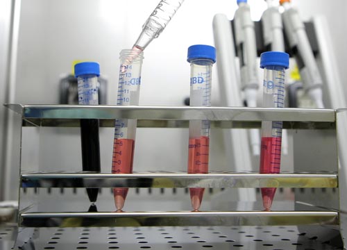 Organi presi organi per studiare inquinamento su corpo. foto degli organi