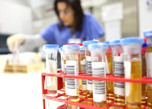 Organi strappati per studiare inquinamento su corpo. organi organi umani
